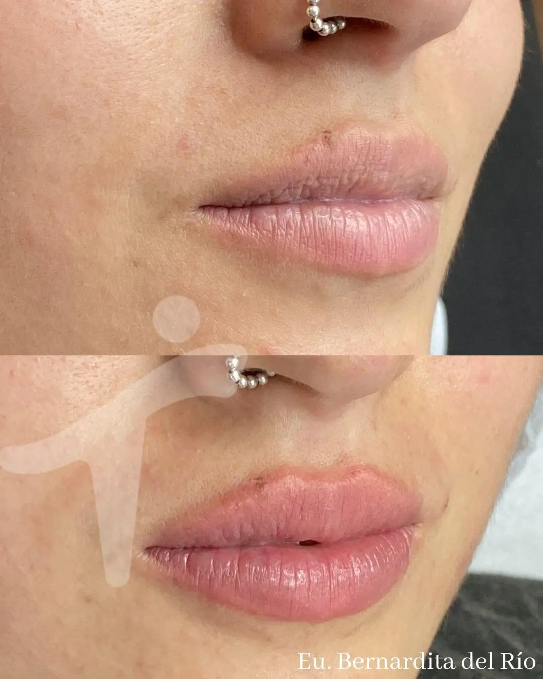 Micropigmentación de labios
