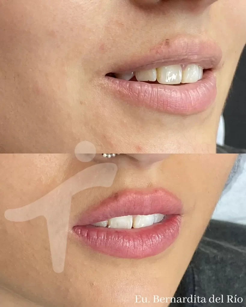 Micropigmentación de labios