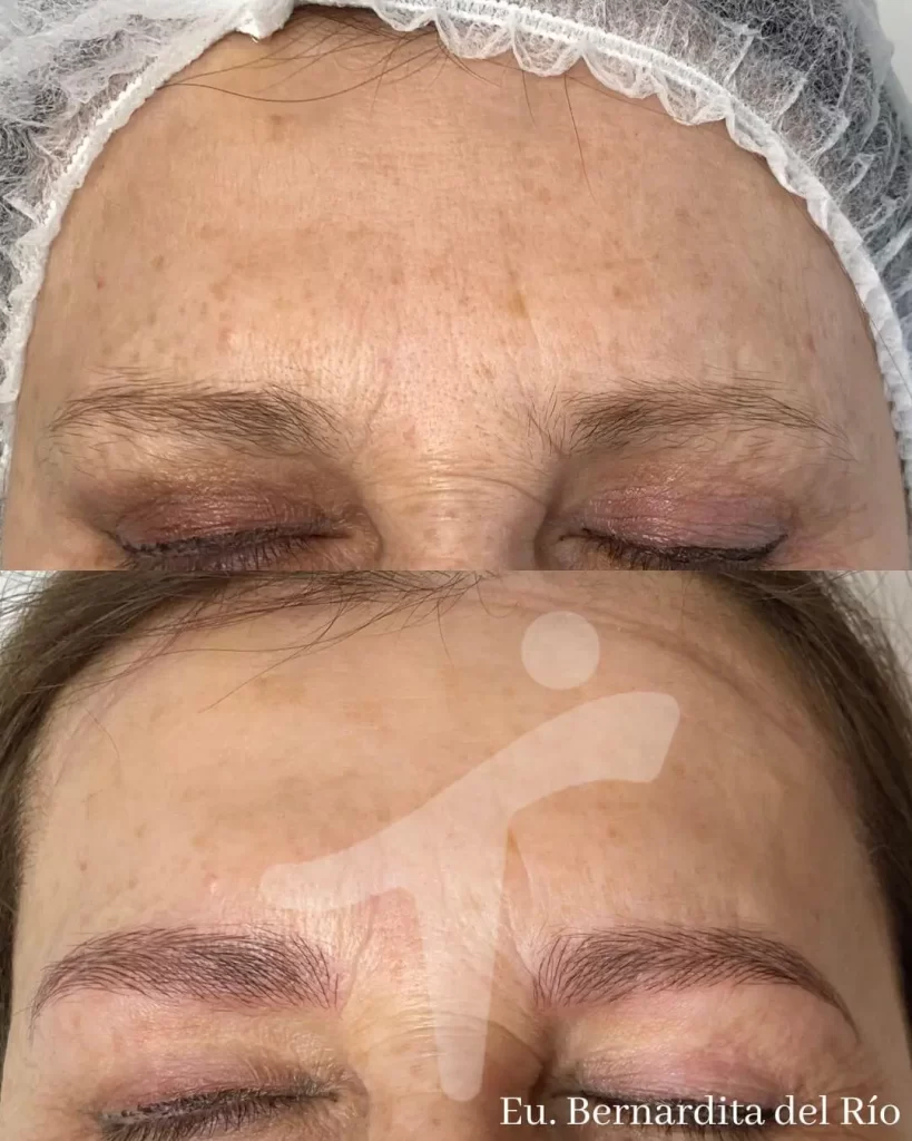 Microblading